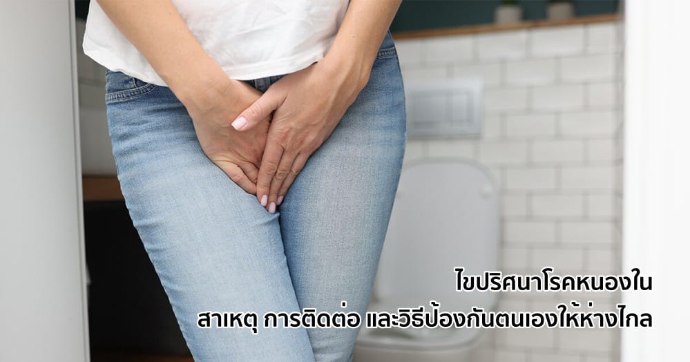หนองใน: การติดต่อ อาการ การตรวจ การรักษา และการป้องกัน